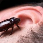How to Remove a Bug from Your Ear How-to-Remove-a-Bug-from-Your-Ear