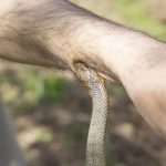How to Treat a Poisonous Snake Bite