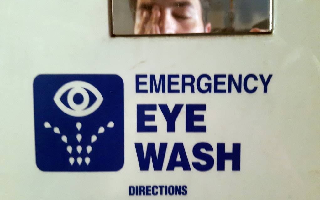 What-You-Should-Do-When-Dangerous-Chemicals-Splash-in-Your-Eye